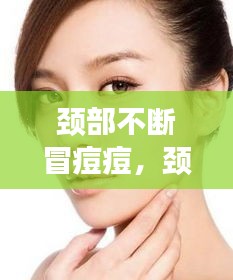 颈部不断冒痘痘，颈部出痘痘是什么引起的 