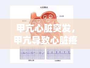 甲亢心脏突发，甲亢导致心脏疼 怎么回事 
